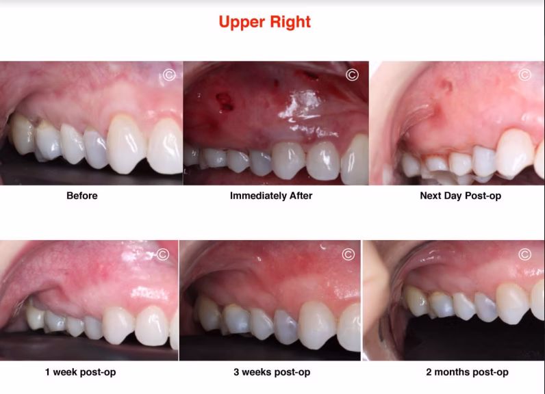 2_upper_right
