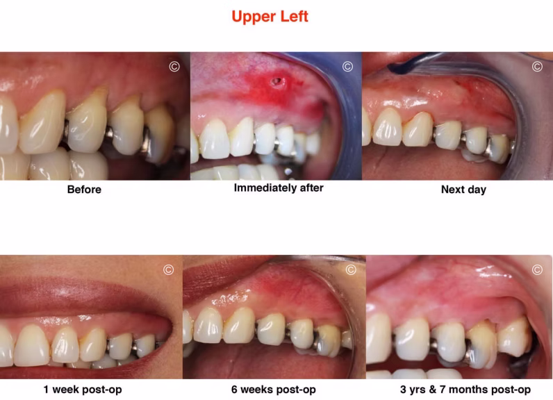 4_upper_left