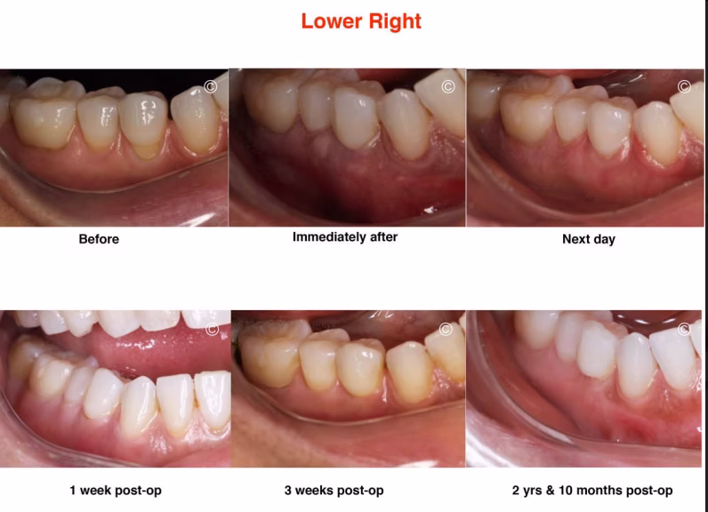 6_lower_right